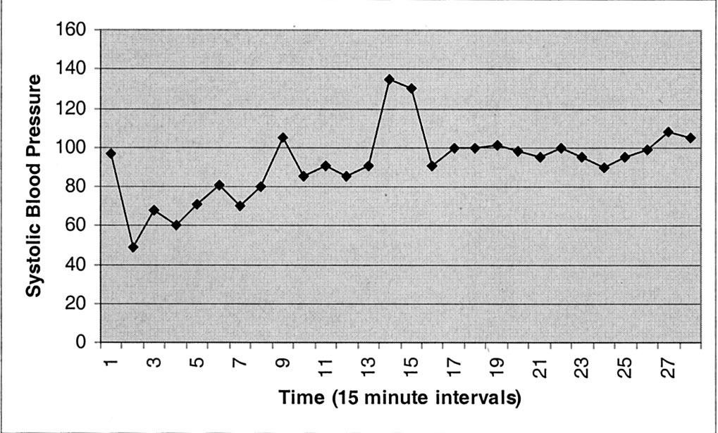 Hypotensive Resuscitation during Active Hemorrhage Fig. 3. An example of blood pressure oscillation and eventual equilibration in a patient from the low-pressure arm of the study.