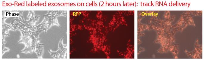 Exo-Glow exosomes added to target cells The labeled exosomes were added to target HEK