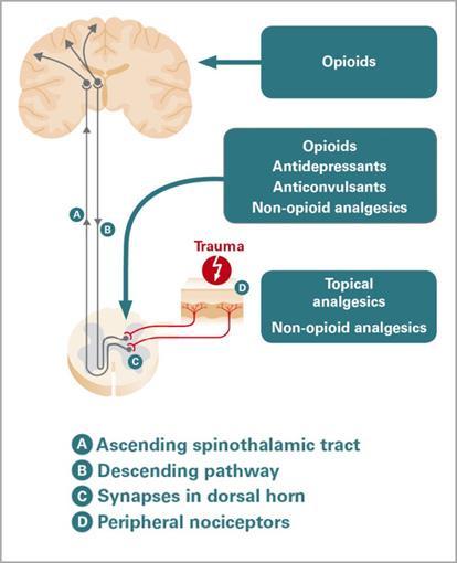 Treatment: Opioids Opioid use for neuropathic pain and CRPS: Controversial Considered if pain is affecting physical therapy participation Low