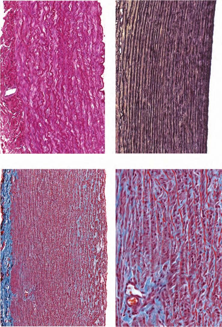 202 CARDIOVASCULAR SYSTEM, BLOOD, AND BLOOD CELL FORMATION A B Elastin fibers Collagen fibers Vasa vasorum C D Figure 7-4.