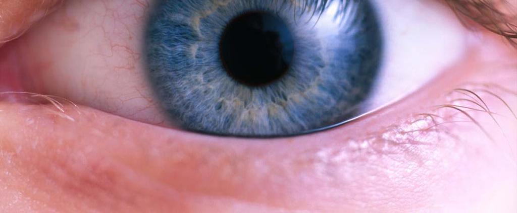 May cause retinopathy. Diabetes eye disease. Treatment includes tight blood sugar control.
