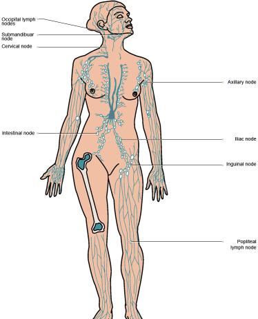 How do cancers spread? Skin cancers, such as squamous cell and melanoma, have the ability to spread to other parts of the body; these are called metastases or secondaries.