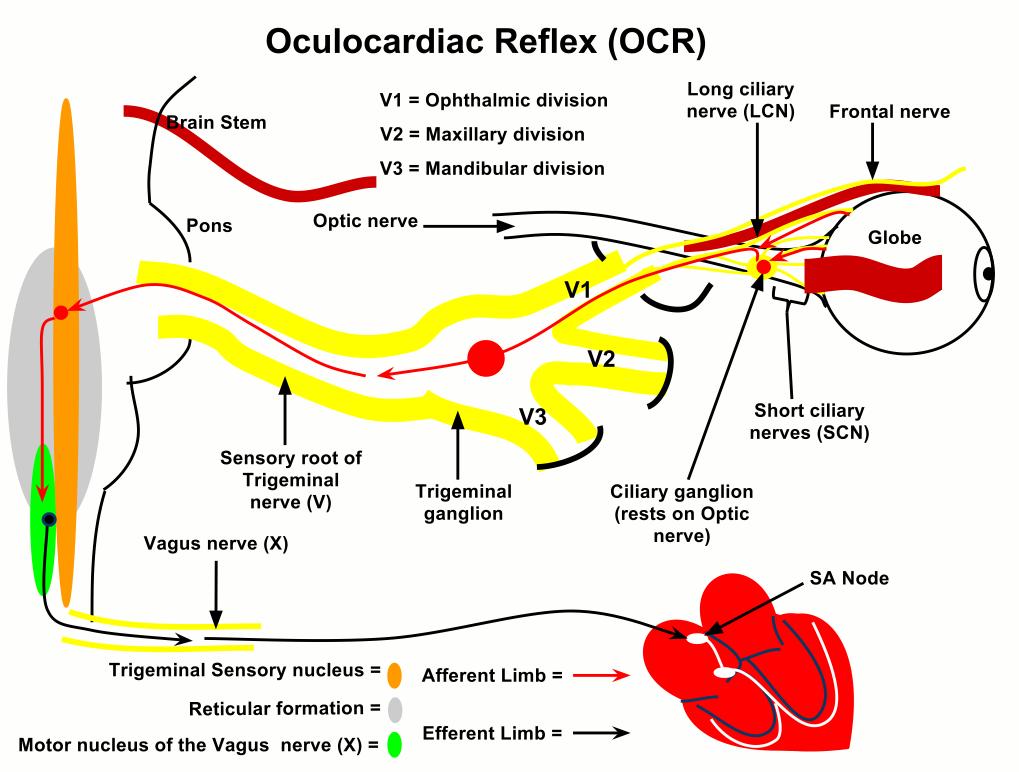 The OCR can be triggered by pressure on the globe; traction on the extraocular muscles, conjunctiva, or orbital structures; regional ophthalmic anesthesia such as a retrobulbar or peribulbar block;