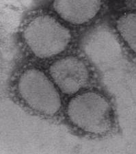 Coronavirus ssrna Virus Helical capsid with enveloped