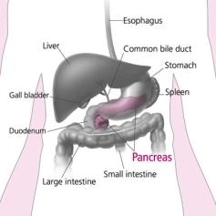 Pancreatic Cancer in Florida (-) 9/1/ Prepared by: Lydia Voti, M.S.