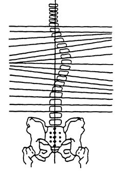 b a Lumbar/Pelvic Relationship Angle (LPR) The LPR is the angle formed by the intersection of the pelvic tilt line (Fig. 8a) and the vertebral tilt line of L-3, L-4, or L-5 individually (Fig. 8b).