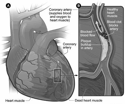 Blood in the heart chambers does not nourish the myocardium The heart has its own nourishing circulatory system 4 major coronary