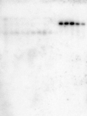 CpAMs Block Formation in NTCP-HepG2 Southern Blot qpcr