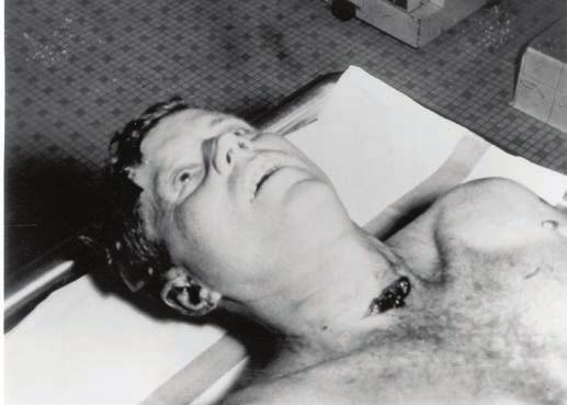 very similar to the damage observed in the President s skull. 26 Mr. Haag accurately describes the tests, and the reported results of those tests, as given to the Warren Commission in 1964 by Mr.