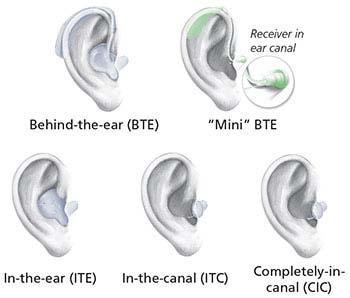 Options for Treatment Remove blockage Surgery Hearing aids o Completely in the canal o In the canal o In the ear o Behind the ear Image Credit: National Institutes of Health National Institute on