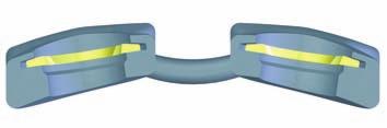 System Overview The Reflex Zero Profile ACP System offers a selection of one- and two-level low profile anterior cervical plates.