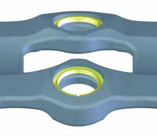 The Ti-6Al-4V alloy plate has minimal material running sagittally through its center, thereby minimizing contact with soft tissue.