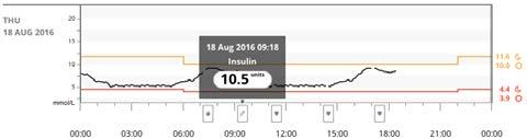 By default, both events are on as indicated by a green slider. Off is indicated by a white slider. To turn these events off so they do not appear on the graphs: Click the CGM slider.