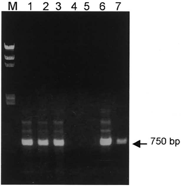Figure 2. Representative agarose gel of polymerase chain reaction products obtained from biopsy specimens, with primers specific for the subgenus Leishmania (Viannia).