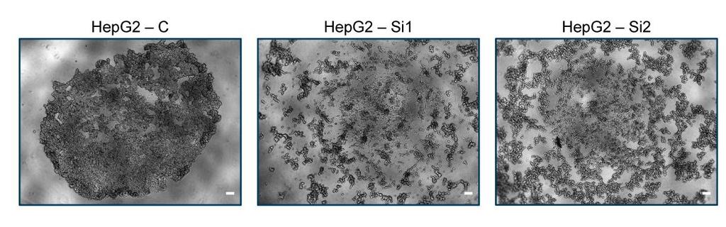NM23-H1 silencing and intercellular adhesion HepG2