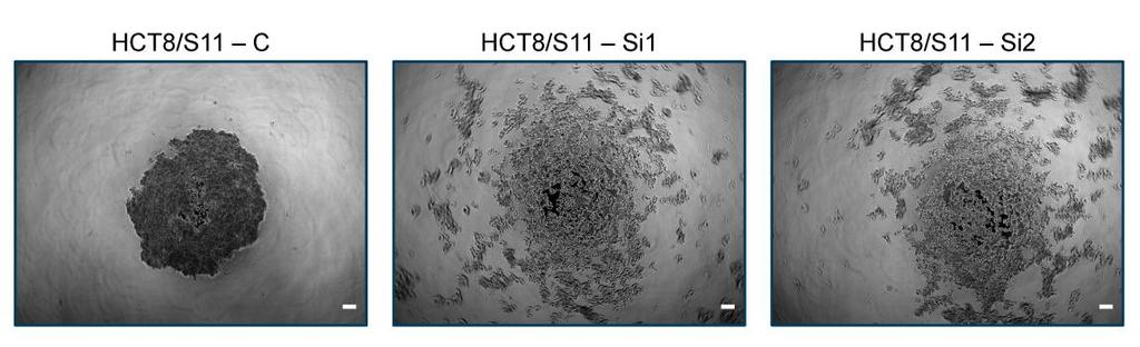 NM23-H1 silencing and intercellular adhesion HCT8/S11 cells fast aggregation