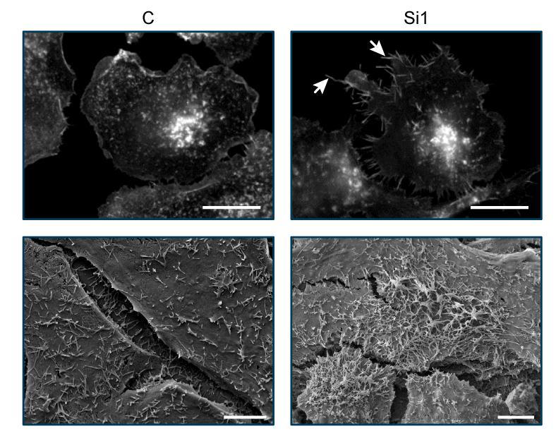 NM23-H1 silencing and actin cytoskeleton