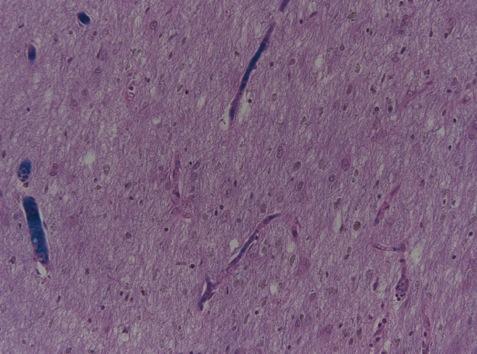 blue (arrows) in a background of intact neurons and glial cells.
