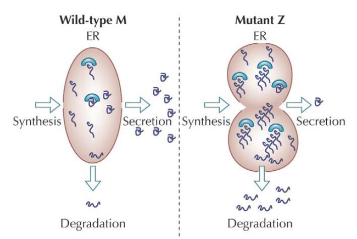 Disease Pathophysiology Z-AAT Conceptual Model for AIAT-Z protein retention in ER Inherited deficiency associated with lung and liver disease.