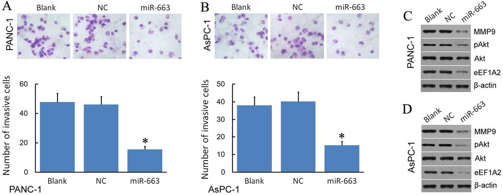 Zang et al. Molecular Cancer (2015) 14:37 Page 7 of 15 Figure 4 mir-663 attenuates pancreatic cancer cell invasiveness. A. mir-663 attenuates pancreatic cancer PANC-1 cell invasiveness.