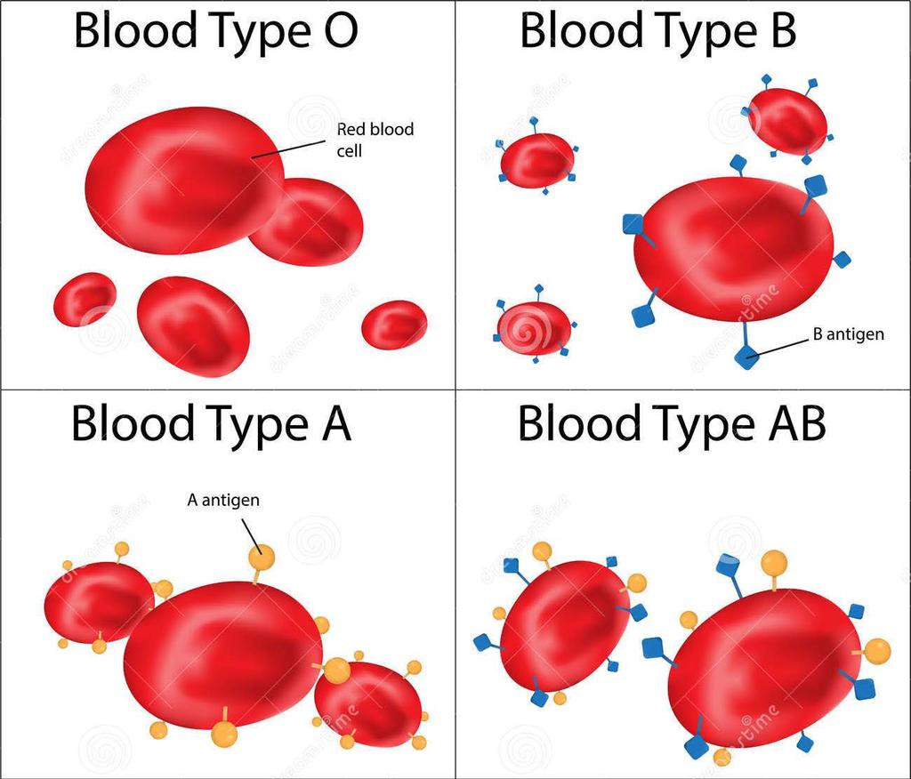 ABO Blood Group Two antigens: A or B Four possible blood types Type O No antigens