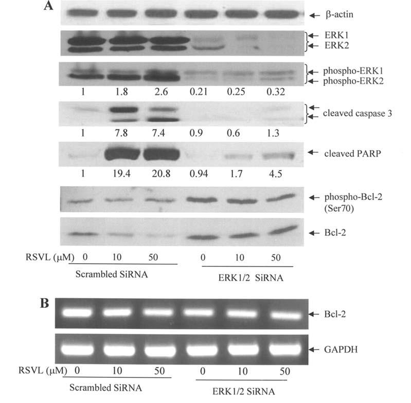 88 NGUYEN et al: THE ROLE OF ERK1/2 ACTIVATION IN RESVERATROL-INDUCED APOPTOSIS Figure 5. Silencing ERK1/2 by SiRNA affects RSVL-induced apoptosis and Bcl-2 expression in MDA231 cells.