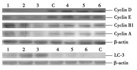 Figure 6. Cyclins and LC-3 detected by Western blot in control group and experiment group.