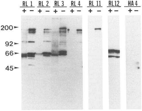 The release of free GlcNAc moieties was monitored by galactosylating aliquots of the digests, and then determining the amount of [3H]-N-acetyllactosamine generated by paper chromatography.