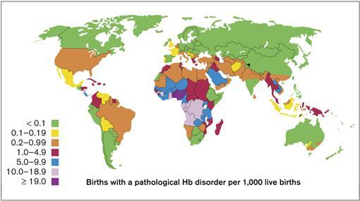 Epidemiology of Hemoglobinopathies 7% of world population carriers of hemoglobinopathies 500.