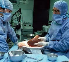 Liver Transplantation Indications o Cirrhosis with complication of disease o Acute Liver