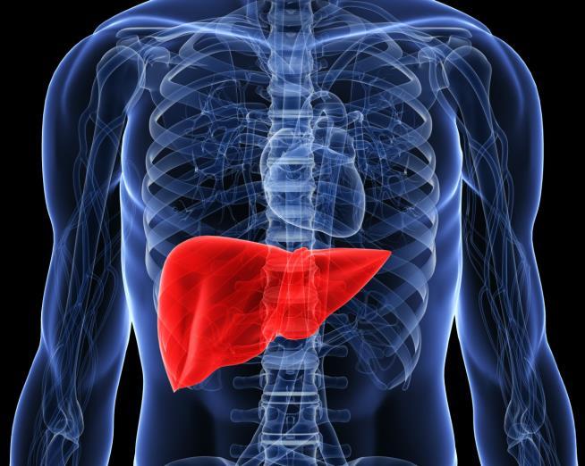 Common Causes of Liver Disease/Liver Failure Infection (hepatitis B, C) Alcohol