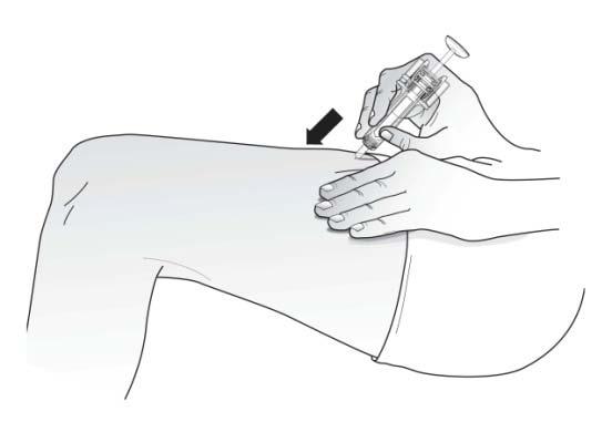 The best places to inject are the top of the thighs, the abdomen, or the outer area of the upper arms. How do you give the injection?