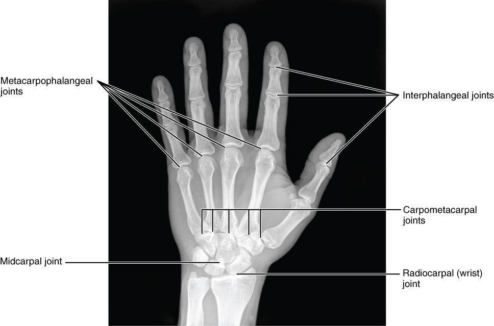 CHAPTER 8 THE APPENDICULAR SKELETON 303 Figure 8.8 Bones of the Hand This radiograph shows the position of the bones within the hand. Note the carpal bones that form the base of the hand.