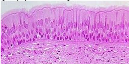 membrane below fibrous glue that anchors tissue