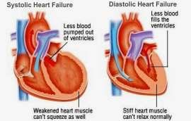 Types of Heart Failure What Can I Do To Help My Heart? #1 Know your medications!