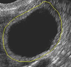 A B C Figure 1.4: Regional analysis of a preovulatory follicle. An image of the follicle is shown with follicle wall identified by the yellow line (A).