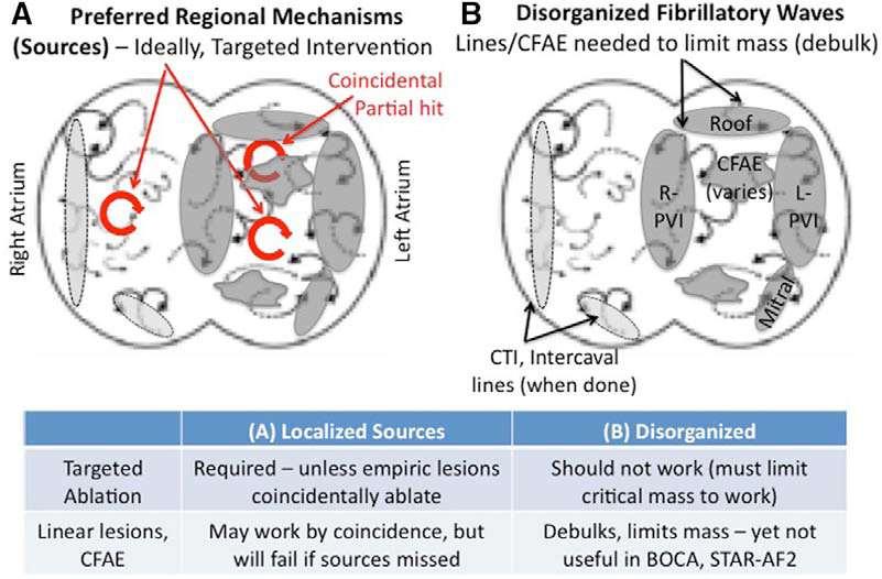 Fundamental AF Mechanisms AF may be driven by 2 fundamental mechanisms: Preferred regional mechanisms (sources) driving disorganized waves or