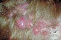 Cylindroma Clinical features Adult F:M ratio 9:1 Smooth red papules, nodules (turban tumors) 90% head and neck, especially scalp Associated with Brooke- Spiegler syndrome