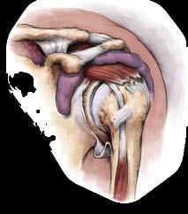 Options Rotator Cuff Repair. Repairing a torn rotator cuff can present a multitude of challenges.