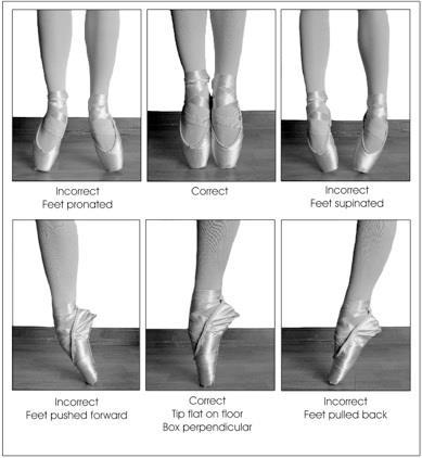 Always ask your dancer patient to describe how much they dance, in what styles, the type of floor