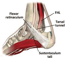 Trigger Toe Trigger Toe, or Flexor Hallucis Longus Tenosynovitis, is an overuse injury that results in inflammation of the tendon sheath Patients present with pain at the postero-medial ankle and may