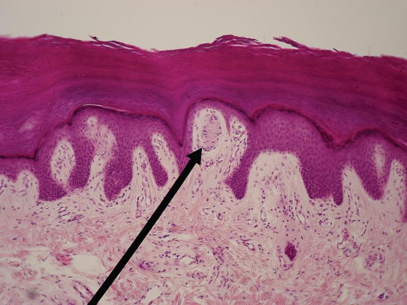 Light Micrograph of a Meissneer Corpuscle In this micrograph of a skin cross-section, you can see a Meissner corpuscle (arrow), a type of touch receptor located in a dermal papilla adjacent to the