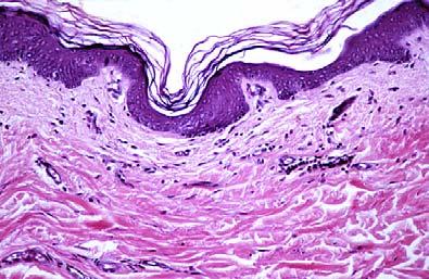 down and causes odor Both are actually merocrine Merocrine Sweat Glands Sweat Glands of the Skin Also called eccrine glands: coiled, tubular glands discharge directly onto skin surface sensible