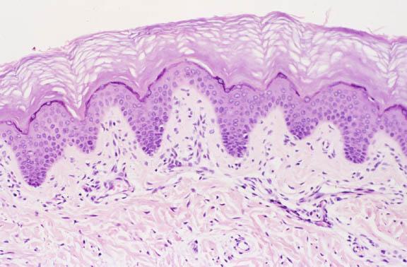 What to look for More skin Papillary layer has ridges is