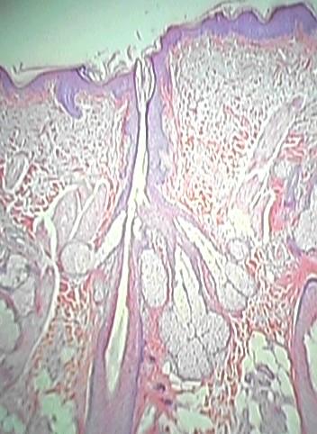 Hair Follicles are rarely complete Can often see root, papilla at base of hair Arrector pilli muscle at an angle Associated glands (which are?