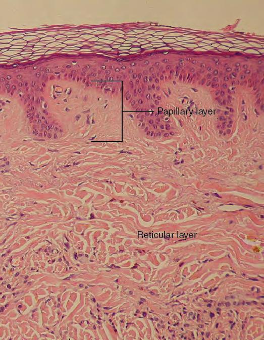 186 Chapter 5 The Integumentary System Figure 5.7 Layers of the Dermis This stained slide shows the two components of the dermis the papillary layer and the reticular layer.