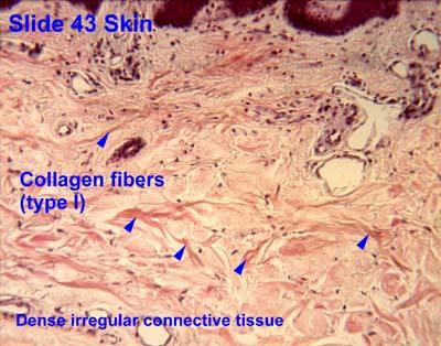 Dense irregular connecive Issue w collagen & elasic fibers very strong, can stretch & recoil