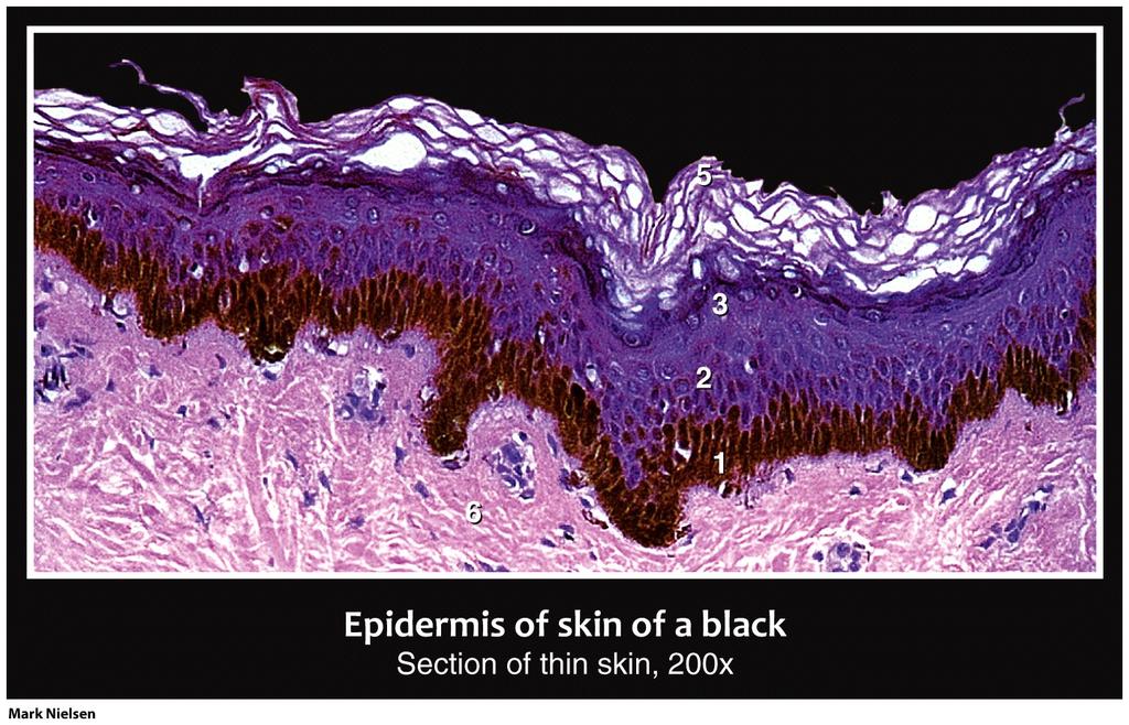 best in hair) Eumelanin - brown to black Skin color Synthesis