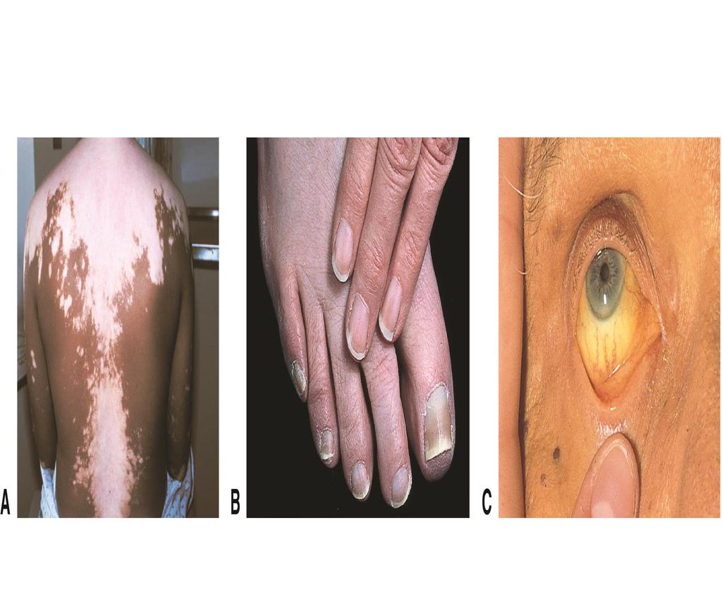 Observations of the Skin (cont.) Figure 6-6 Discoloration of the skin.