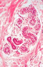 ) Eccrine gland secretion, commonly called sweat, is a hypotonic filtrate of the blood that passes through the secretory cells of the sweat glands and is released by exocytosis.